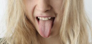 Vrouw steekt haar tong uit als illustratie van AI-technologie die ziekten kan herkennen aan tongkleur.